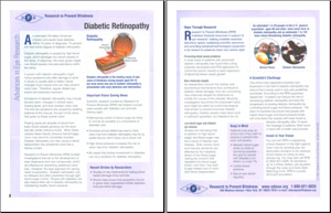 diabetic retinopathy