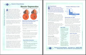 macular degeneration