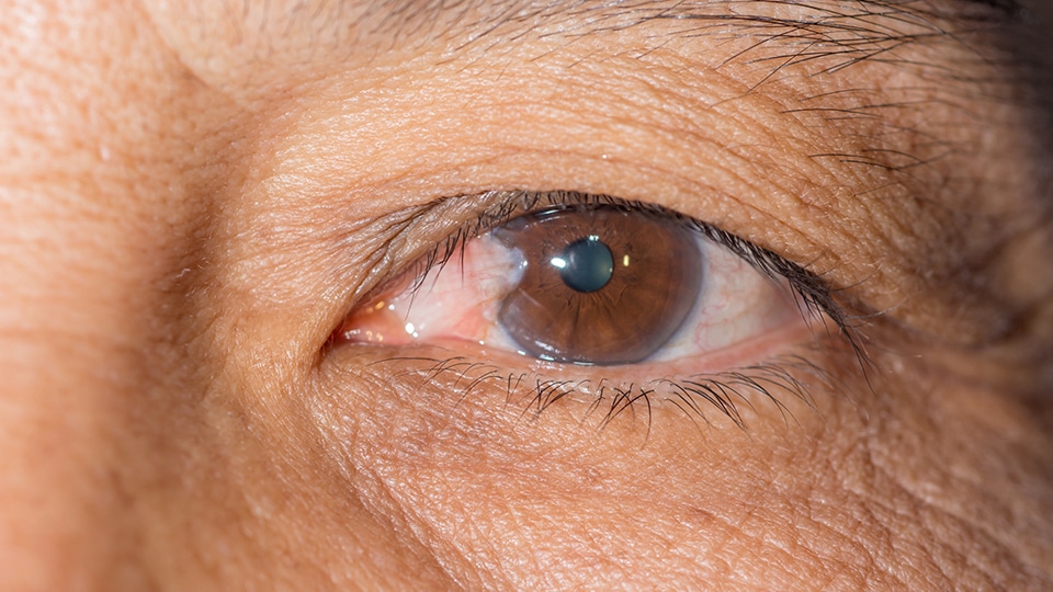 mkg cornea service graphic
